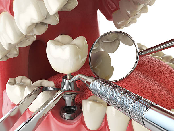 Best Emergency Treatment for Dental Infections or Abscesses in Woodall, OK
